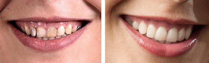 Porovnajte „PRED a PO“ a až potom sadnite do kresla!