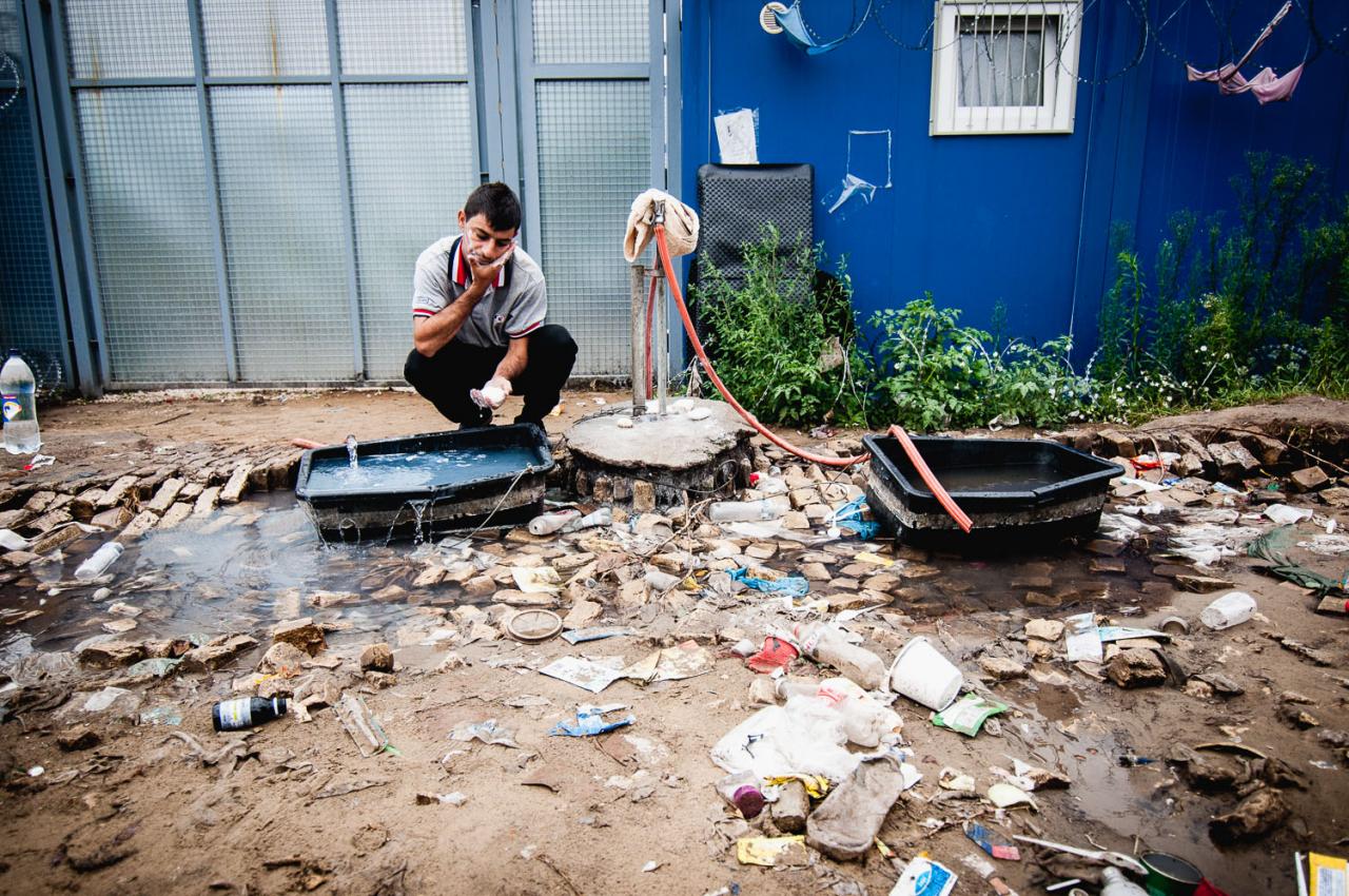 6. august 2016, tranzitná zóna Kelebija, Srbsko: Jezídsky muž, ktorý sa v irackom Kurdistane stretol s bojovníkmi Daešu. Pravé rameno a chrbát má zjazvené od vriacej vody, ktorou ho polievali pre jeho vierovyznanie. Z Iraku sa mu podarilo utiecť až sem.