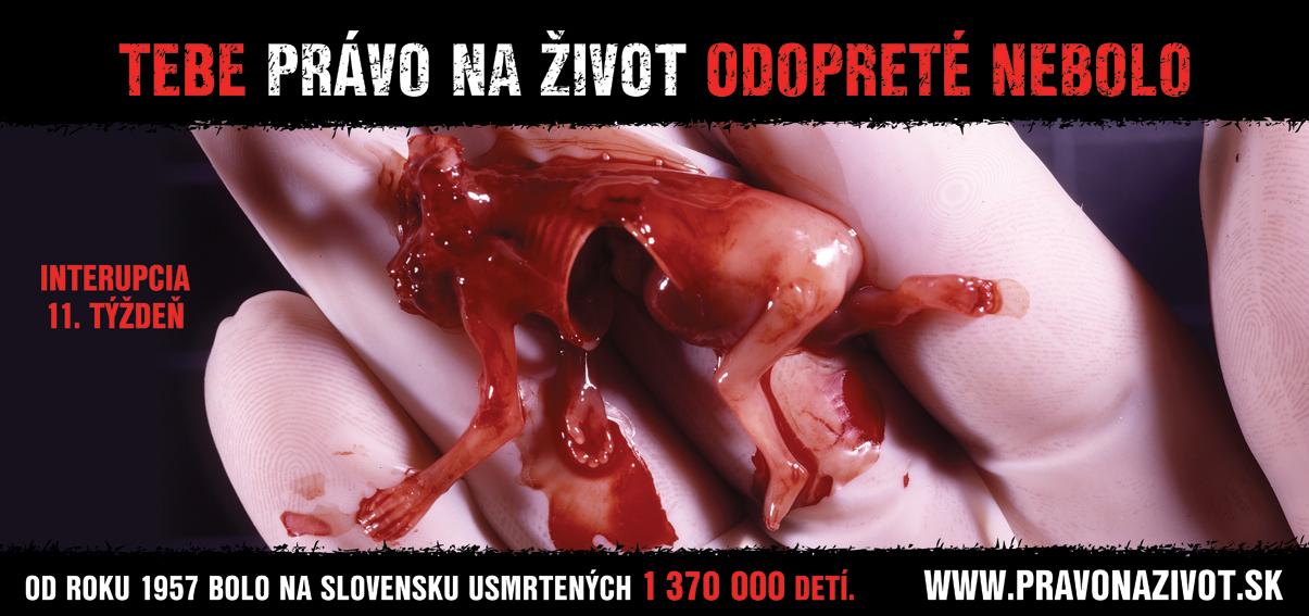 Kampaň Právo na život z roku 2007 v Slovenskej republike
