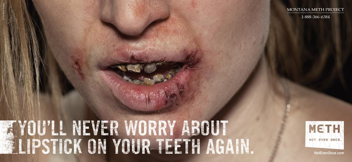 Rúž na zuboch vám už nikdy nebude robiť starosti. (Pervitín – ani ho neskúšaj)