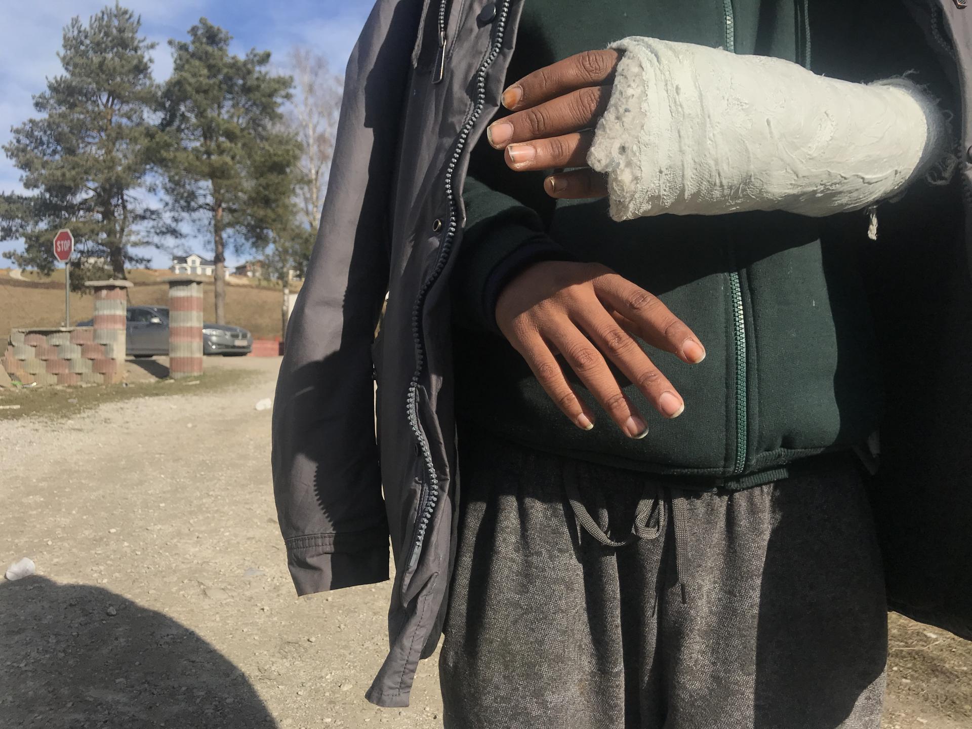 Sadra na ruke tridsaťročného Jasina z Iraku, ktorý je na úteku už dva roky. 