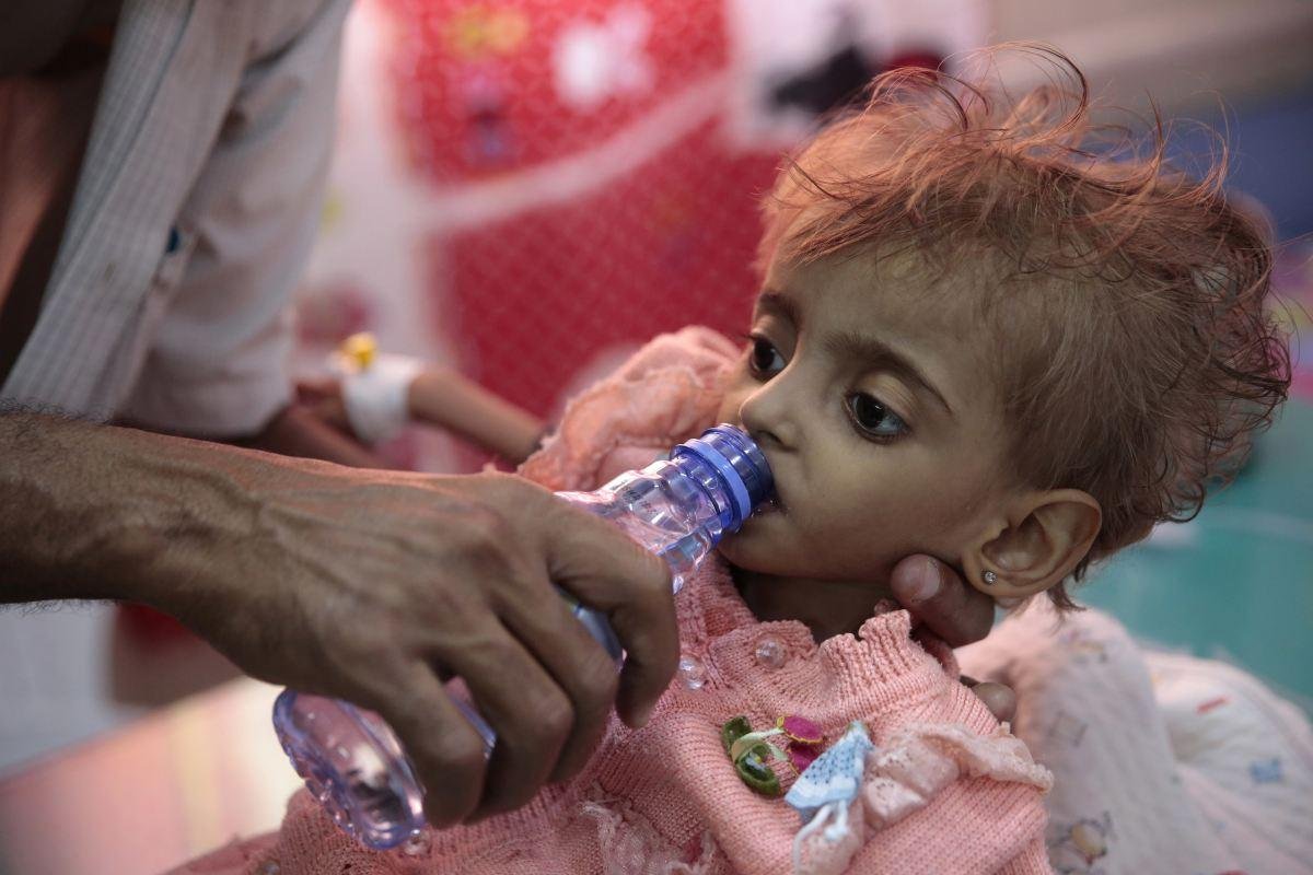 Z detí sú len vrecia kostí. Neviditeľná vojna v Jemene sa mení na najväčší hladomor súčasnosti
