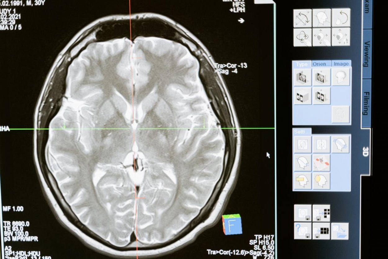 Násilie a jeho dopad na fungovanie nášho mozgu