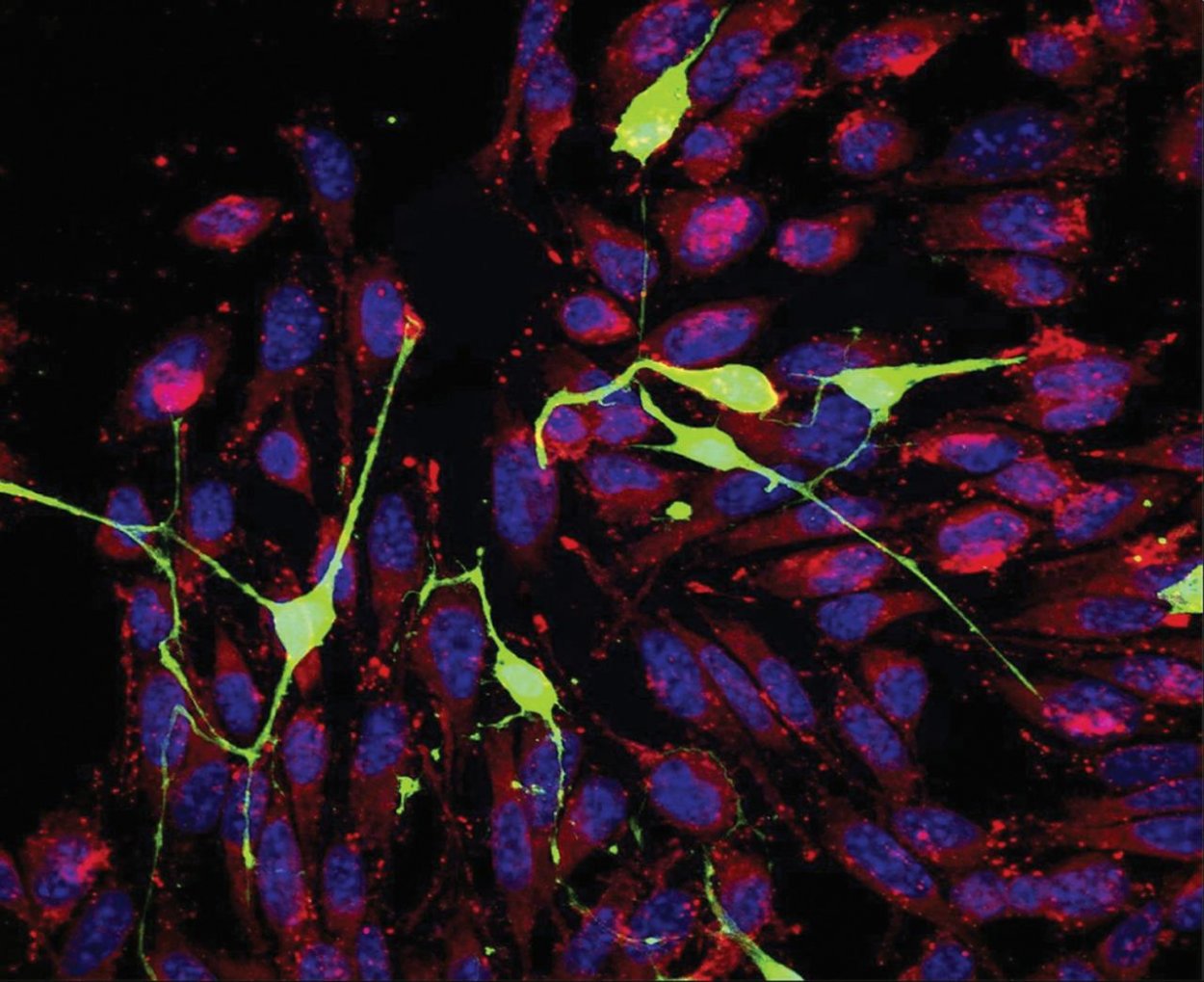 Zlodejstvá rakovinových buniek