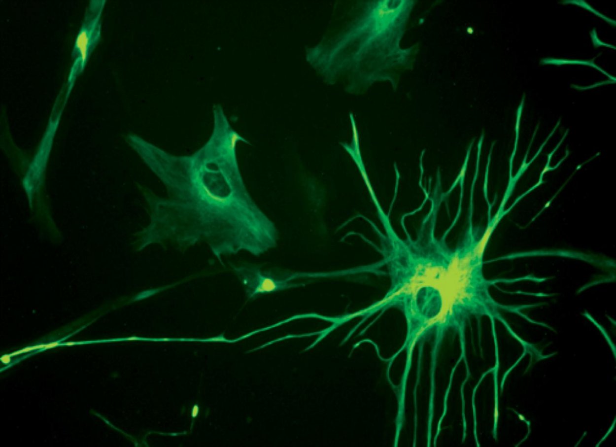 Mozgové hviezdy kódujú spomienky s emočnou príchuťou