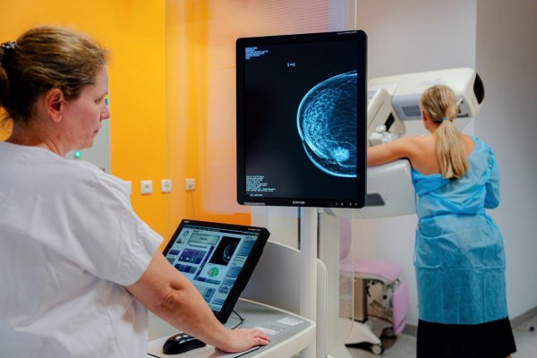 Najčastejšia rakovina u žien ohrozuje aj mužov: Na Slovensku nie sme výnimkou